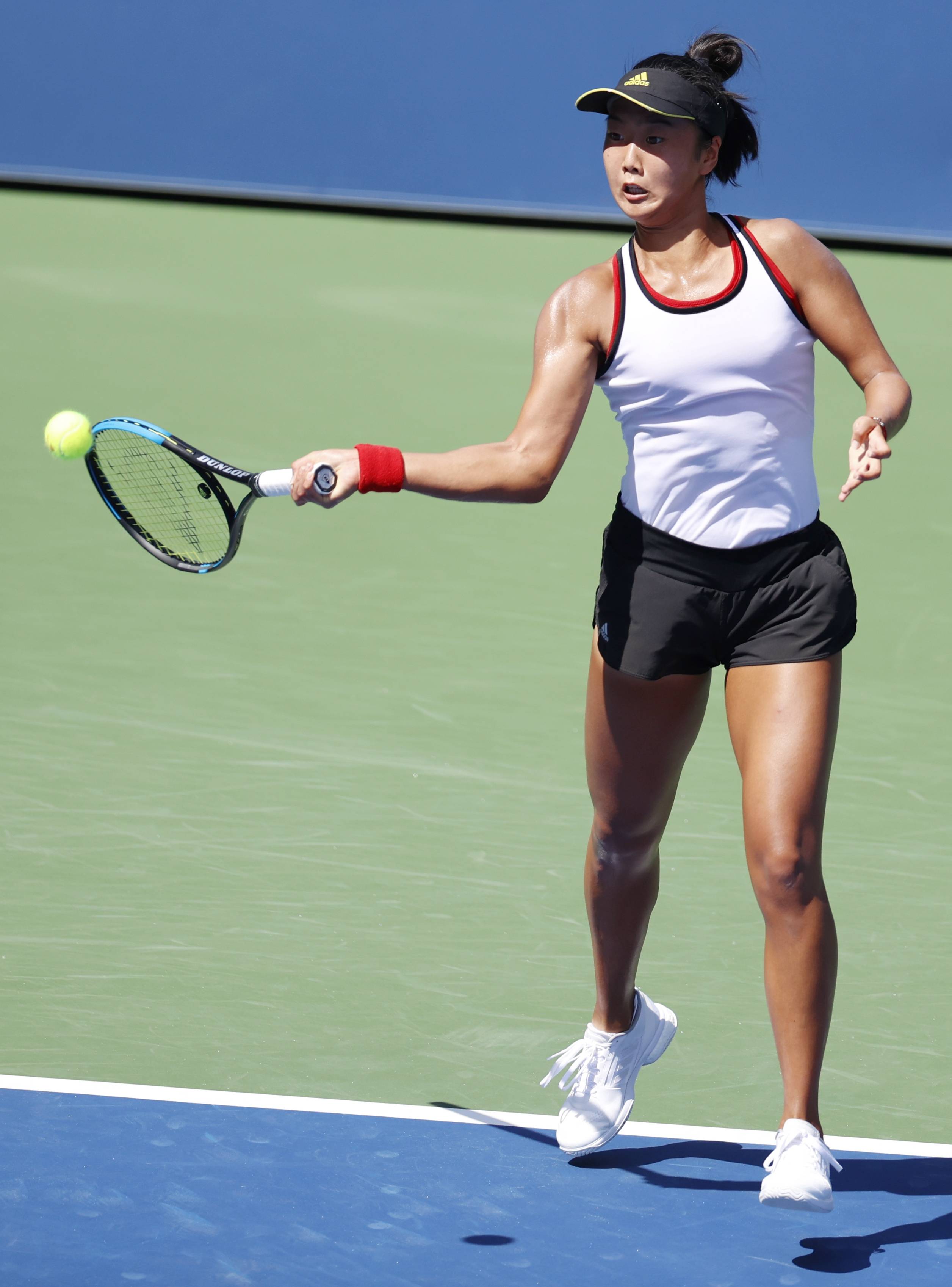 语言障碍可 语言障碍可